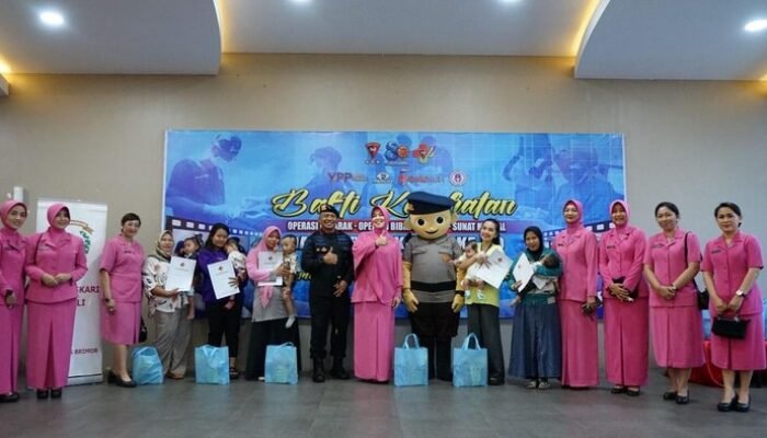 **HUT ke-80, Korps Brimob Berikan Operasi Bibir Sumbung Gratis untuk 21 Anak dari Berbagai Daerah**