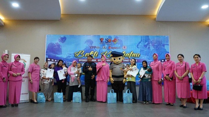 **HUT ke-80, Korps Brimob Berikan Operasi Bibir Sumbung Gratis untuk 21 Anak dari Berbagai Daerah**