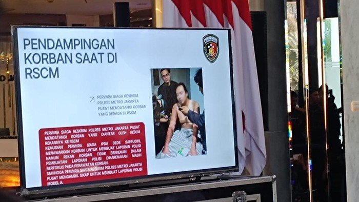 RSCM: Andrie Yunus Stabil, Tapi Apakah Ini Pertanda Pemulihan atau Hanya Sementara?